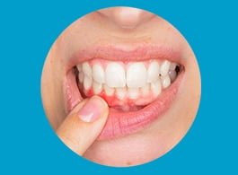 home5 PERIODONTICS GUM THERAPY