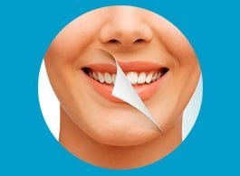 home9 DENTAL SCALING / PROPHYLAXIS / CLEANING